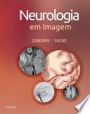 Neurologia em Imagem
