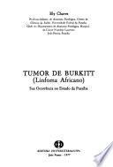 Tumor de Burkett (Linfoma Africano), sua ocorrência no Estado da Paraíba