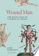 Wound Man